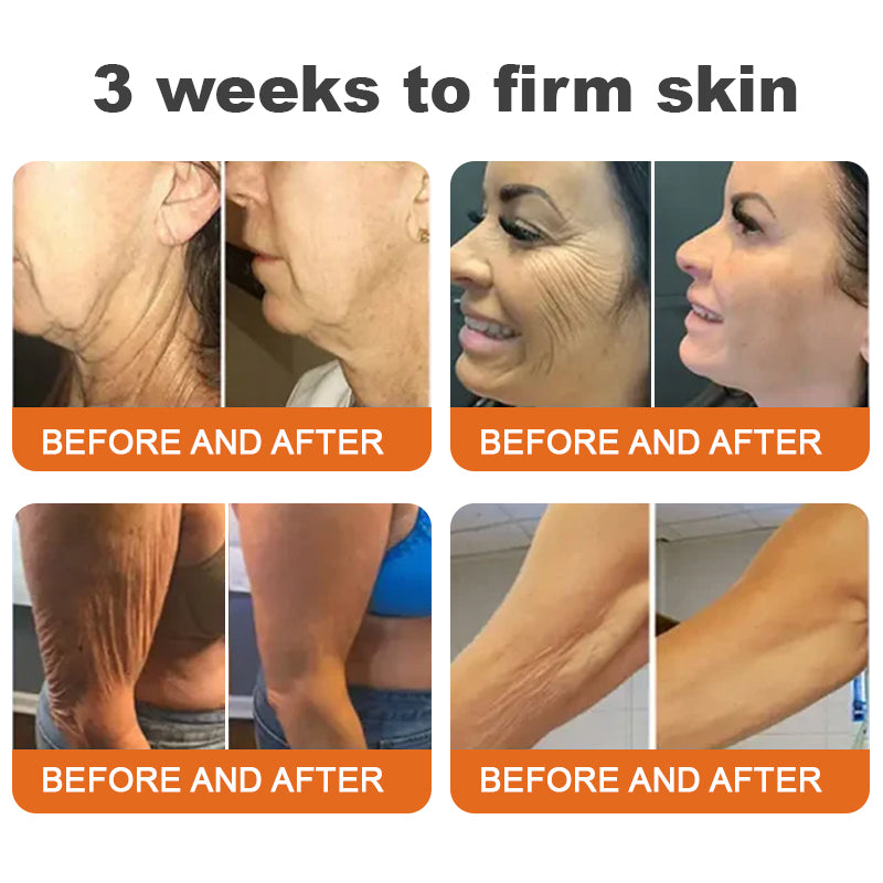 2X1🎁Flysmus™  ⭐⭐⭐⭐⭐Botox Bee Venom Firming Serum
