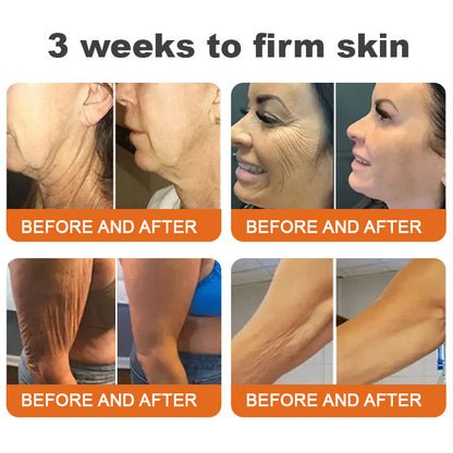 2X1🎁Flysmus™  ⭐⭐⭐⭐⭐Botox Bee Venom Firming Serum
