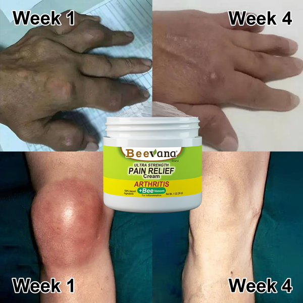 OBTÉN 2 UNIDADES - Crema de terapia para articulaciones y huesos con veneno de abeja Beevana™