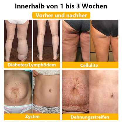 Anyidea® Short⭐ ⭐ ⭐ ⭐ Tegnologia que cuida tu cuerpo
