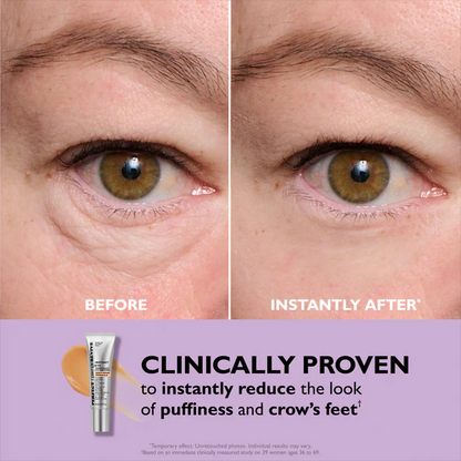 🌸 Instant Eye Tightener ⭐⭐⭐⭐⭐ máxima elevación y suavidad✨