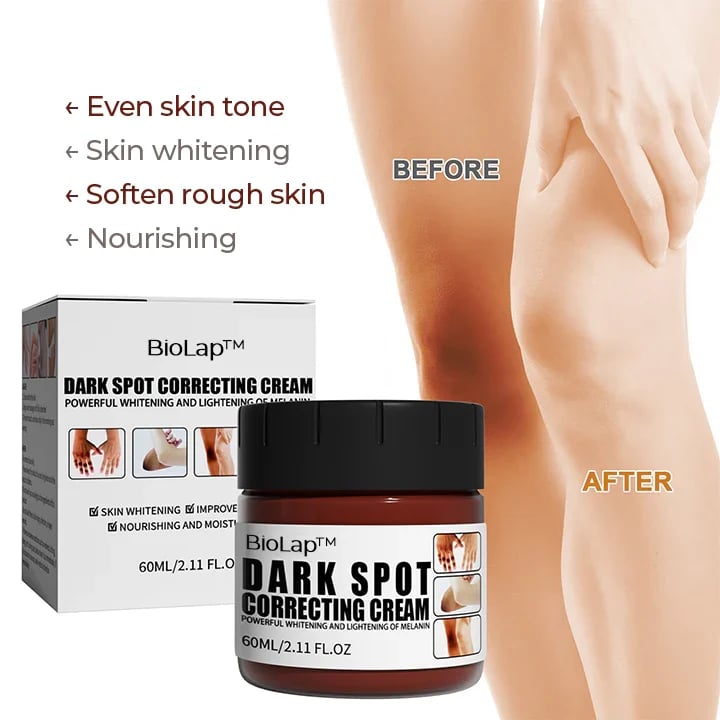 Biolap™ Dark Spot🥥Crema correctora de manchas oscuras🐌