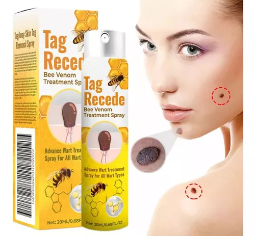 TAG RECEDE TIWORLD™🐝2 X 1🐝AEROSOL PARA VERRUGA Y LUNARES🐝👨‍⚕