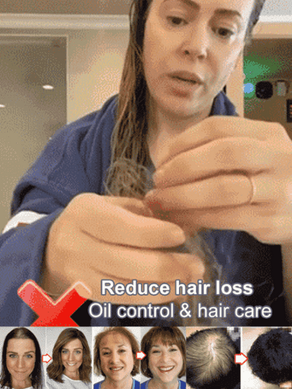 Shampú Yaopin🧴"Melena Renacida":🧬¡Despierta tu Cabello y Recupera tu Confianza!