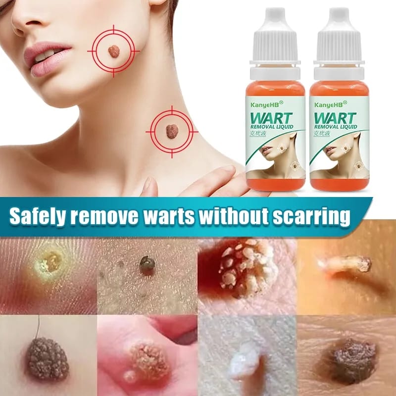 🌿WART REMOVAL LIQUID⭐⭐⭐⭐⭐QUITA VERRUGAS LIQUIDO😱