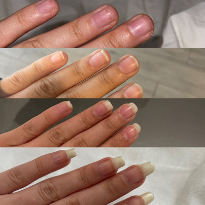 ENDURECEDOR DE  UÑAS 4K  POTENTE⭐⭐⭐⭐⭐  CRECIMIENTO & HONGOS